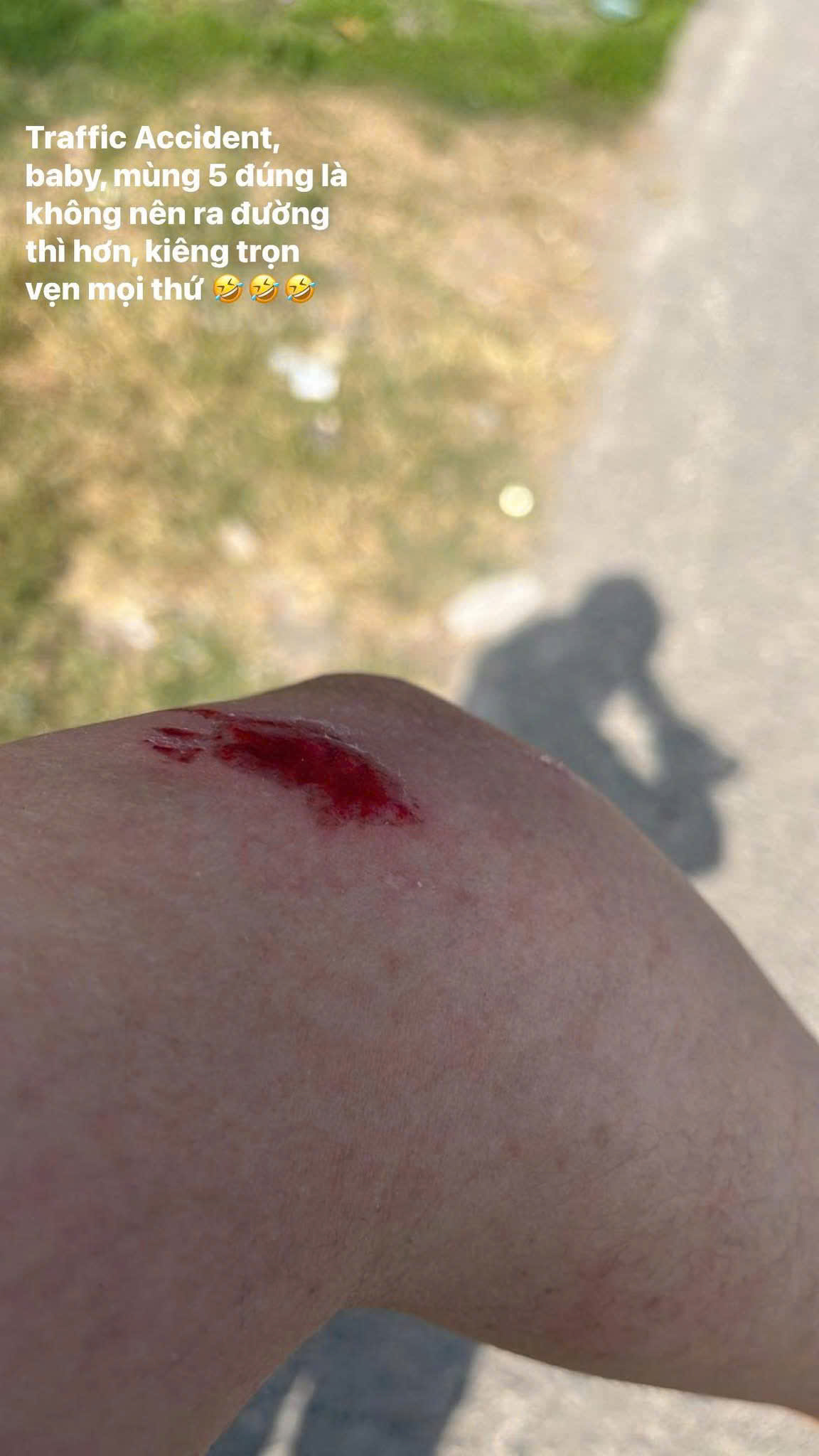 Accident